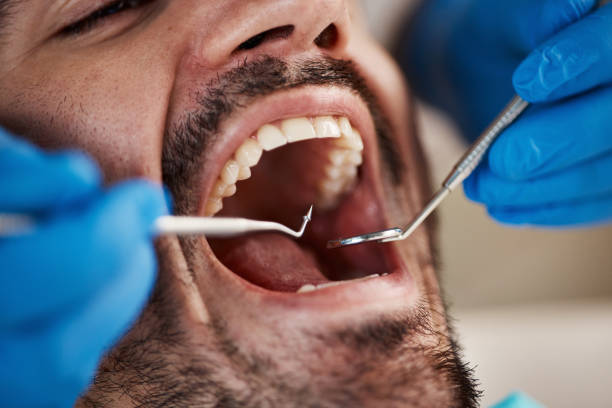 Best Root Canal Treatment  in Fairbury, IL